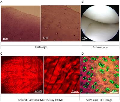 Assessment of Articular Cartilage by Second Harmonic Microscopy: Challenges and Opportunities
